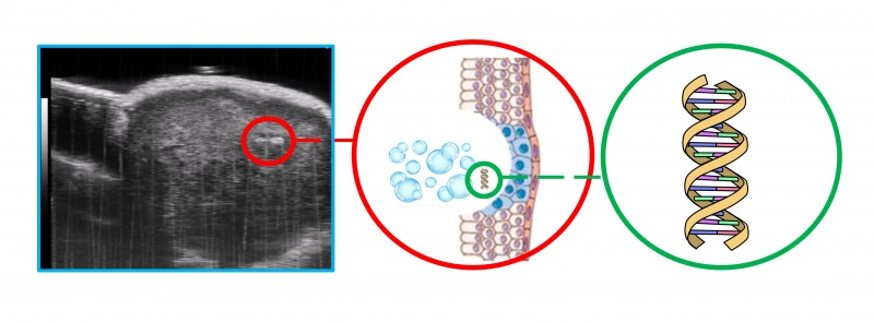 Imagen: Imagen de ultrasonido de la liberación de biomarcadores en un tumor (foto cortesía de Joy Wang y Pradyumna Kedarisetti)